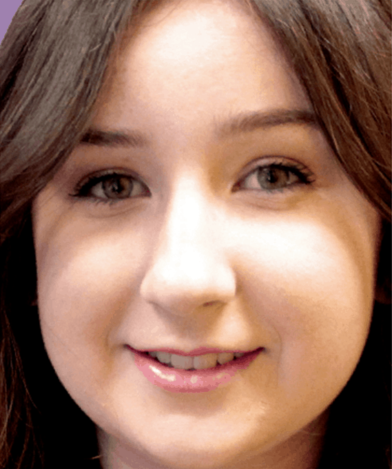 forever clear BBL at Lux Med Spa