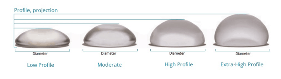 breast-augmentation-profiles breast implants