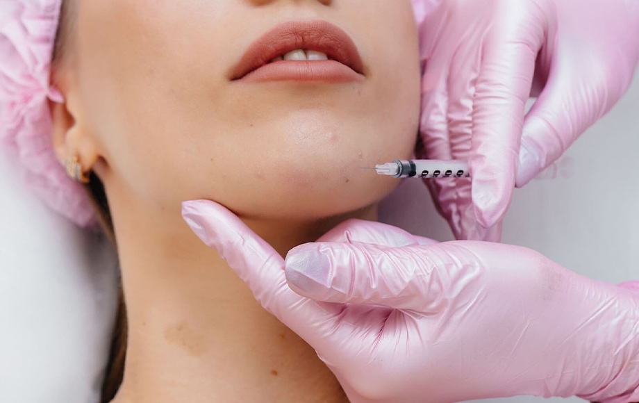 Chin Augmentation With Fillers