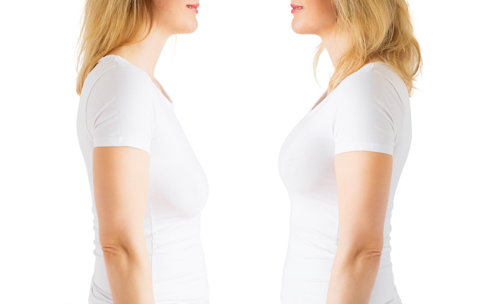 Breast Lift and Implants