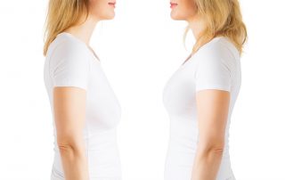 Breast Lift and Implants