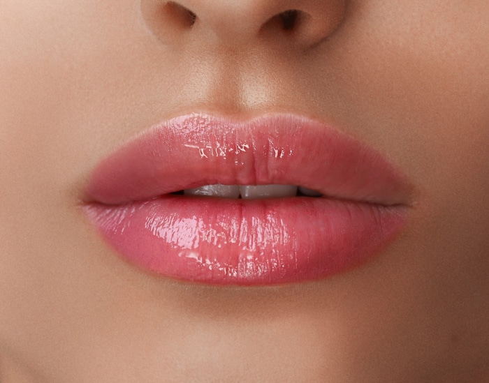 How long do Lip Fillers last?