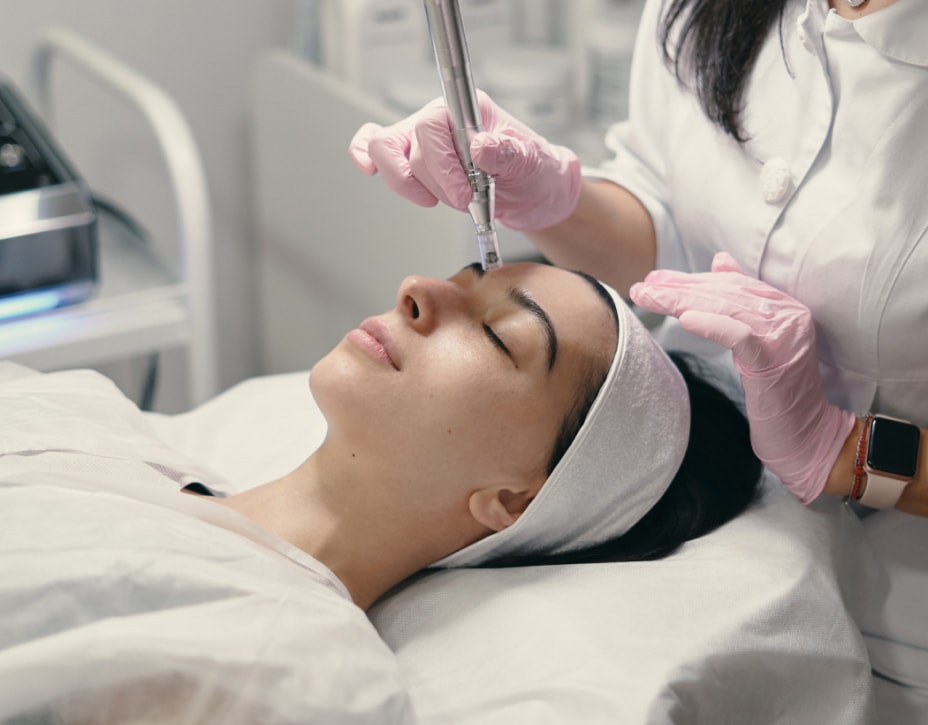 Microneedling with PRP at lux med spa atlanta georgia GA non surgical